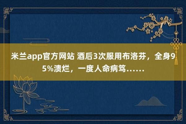 米兰app官方网站 酒后3次服用布洛芬，全身95%溃烂，一度人命病笃……